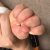 赤ちゃんの指の間が赤いブツブツが発生した体験談！湿疹の原因と対処